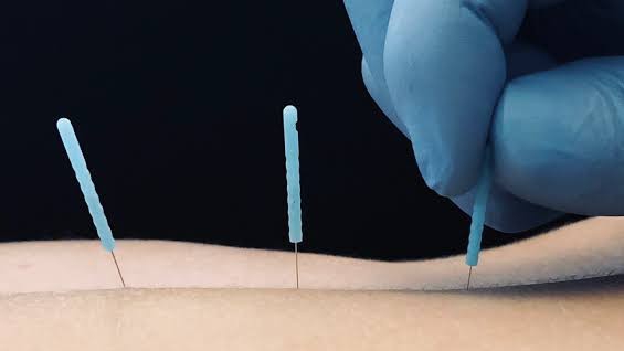 THE BODY MECHANIC (Michelle)