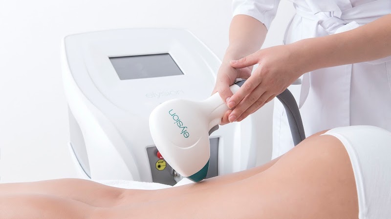 Dream Body & More, Elysion Pro Laser Hair Removal & LPG Anti-Cellulite Beauty