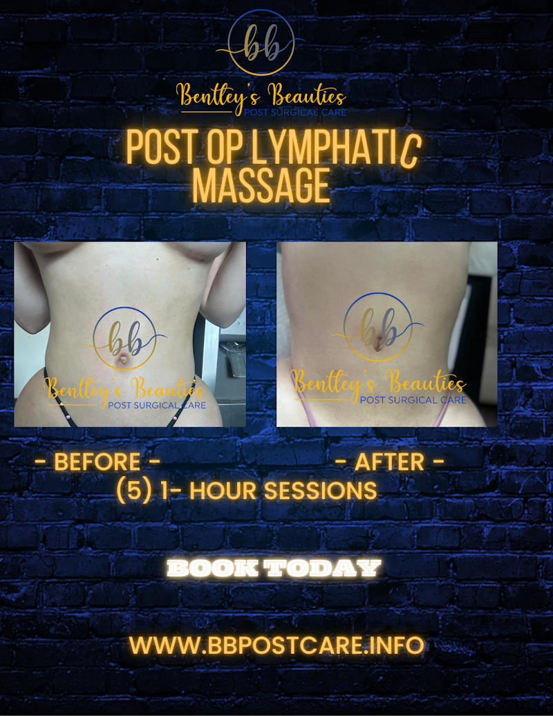 Bentleys Beauties – Post Surgical Care