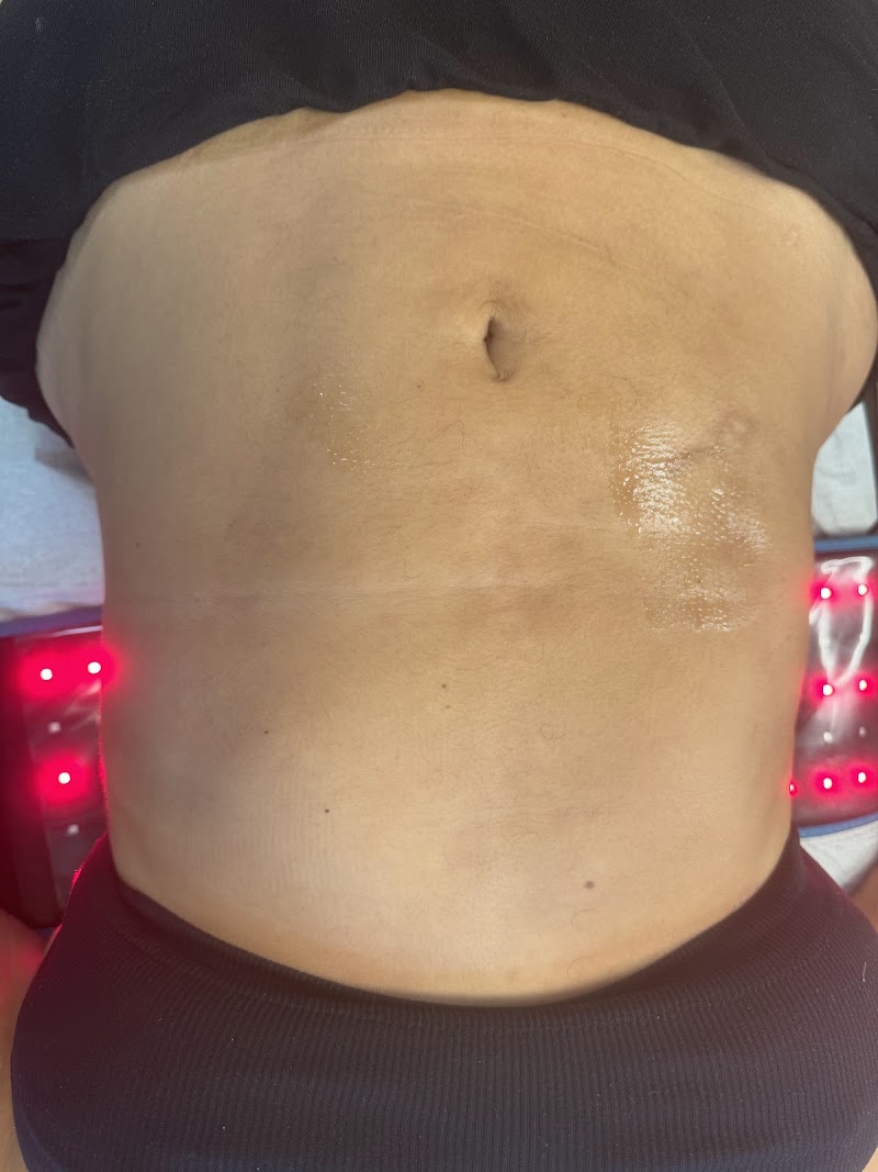 Bodysculpting By Vanessa Saboun