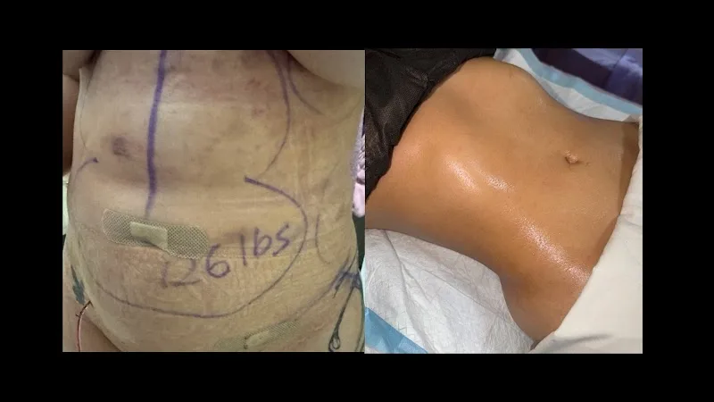Magic Post Op