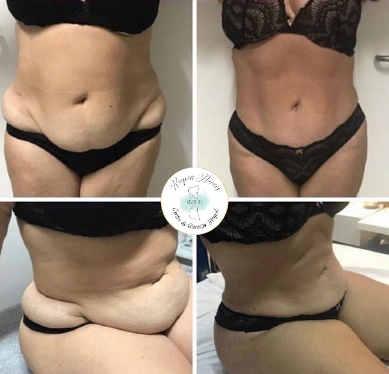 Estética Rayen Anais Aesthetics – Santiago