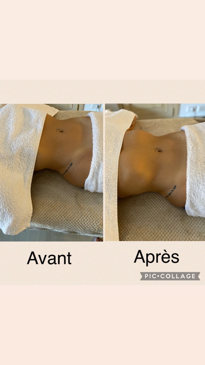 Méthode Renata França by Emily – Drainage Lymphatique